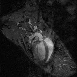 Mouse Aortic Root